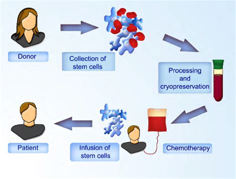 da prada gian antonio|Allogeneic blood stem cell transplantation after a reduced .